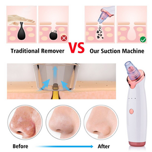 Blackhead Remover Skin Care Pore Vacuum Acne Pimple Removal Vacuum Suction Tool Facial Diamond Dermabrasion Skin Care Machine